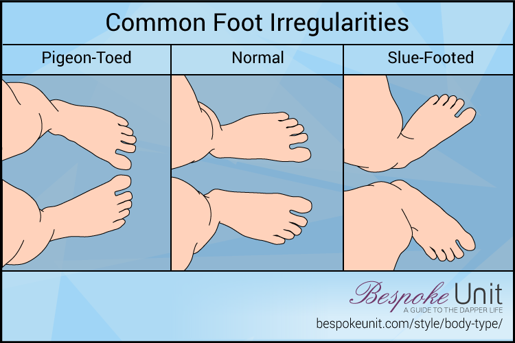 Common Foot Irregularities