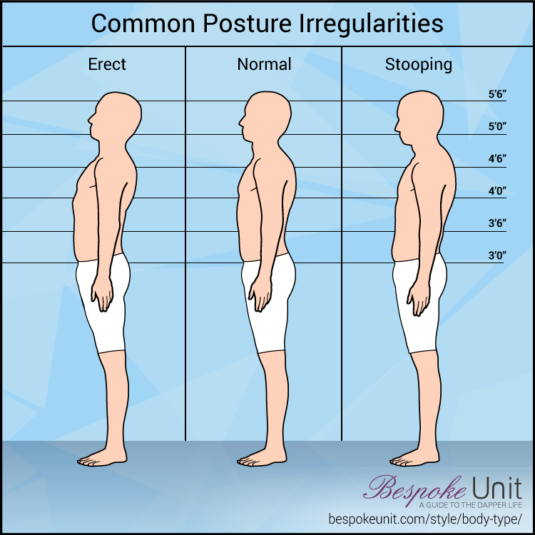 Common Posture Irregularities