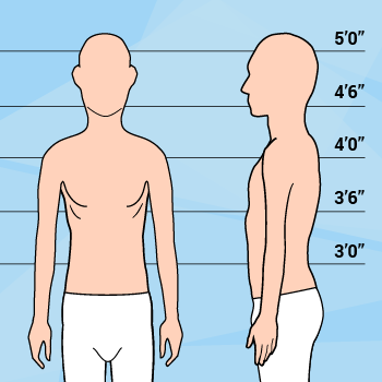 Graphic Of Short Thin Man Against Height Markers