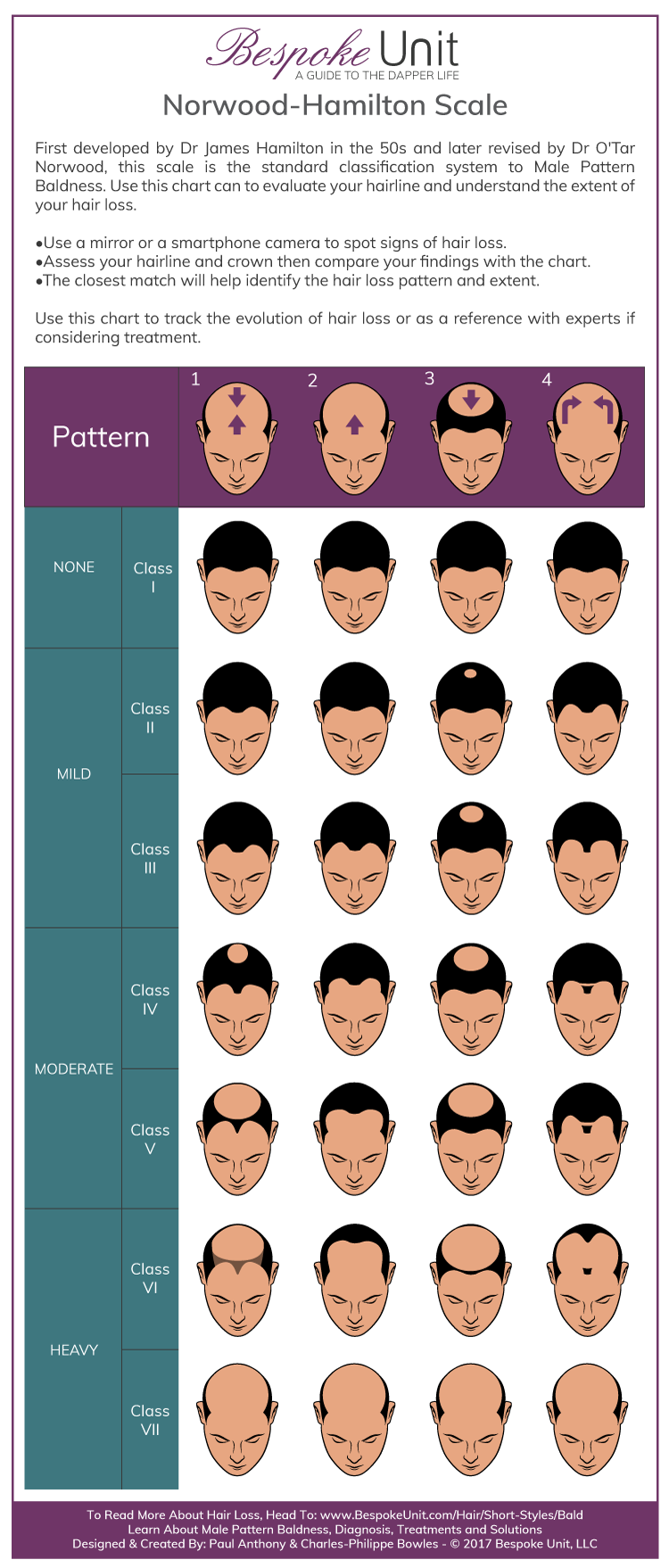 Norwood Hamilton Scale Hairloss Pattern Baldness Infographic Guide