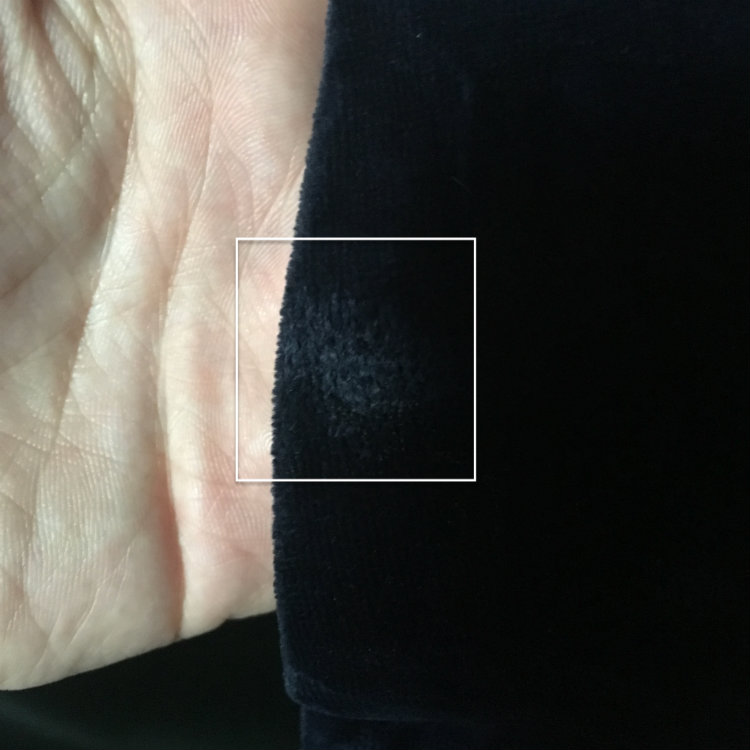 scorch mark on coat sleeve