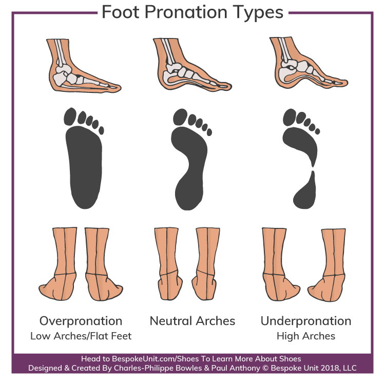 Different Types of Foot Arch Pronations